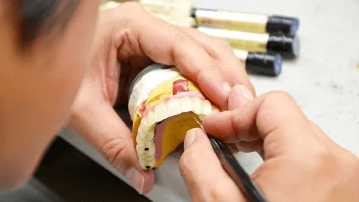 精密な技工物