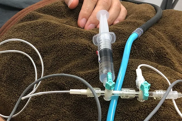 静脈内鎮静法
