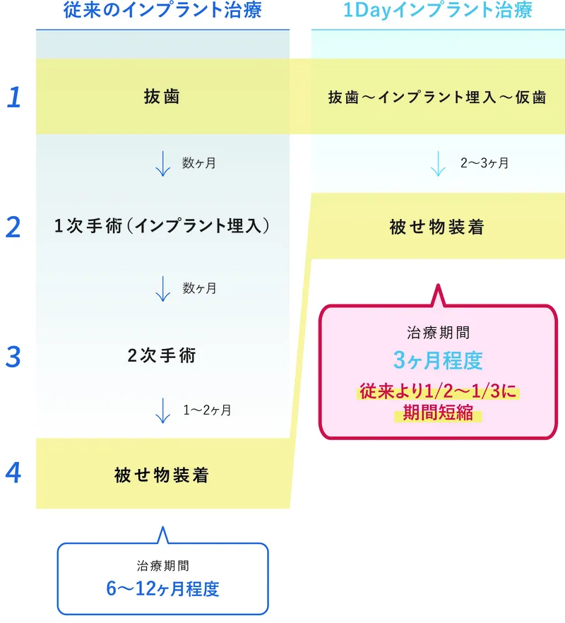 1Dayインプラントとの比較