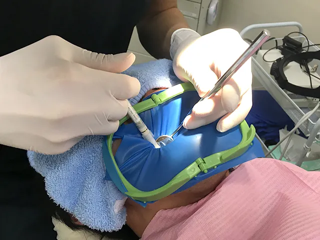 ラバーダム